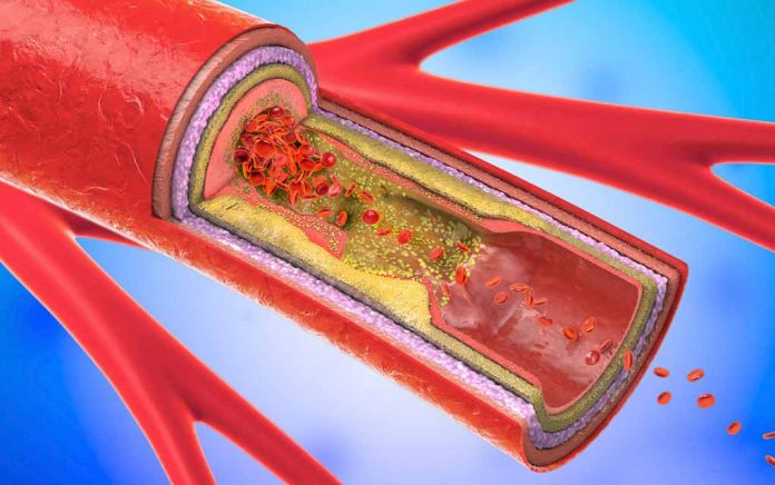 5-Signs-Your-Arteries-are-Clogged-(and-What-To-Do)